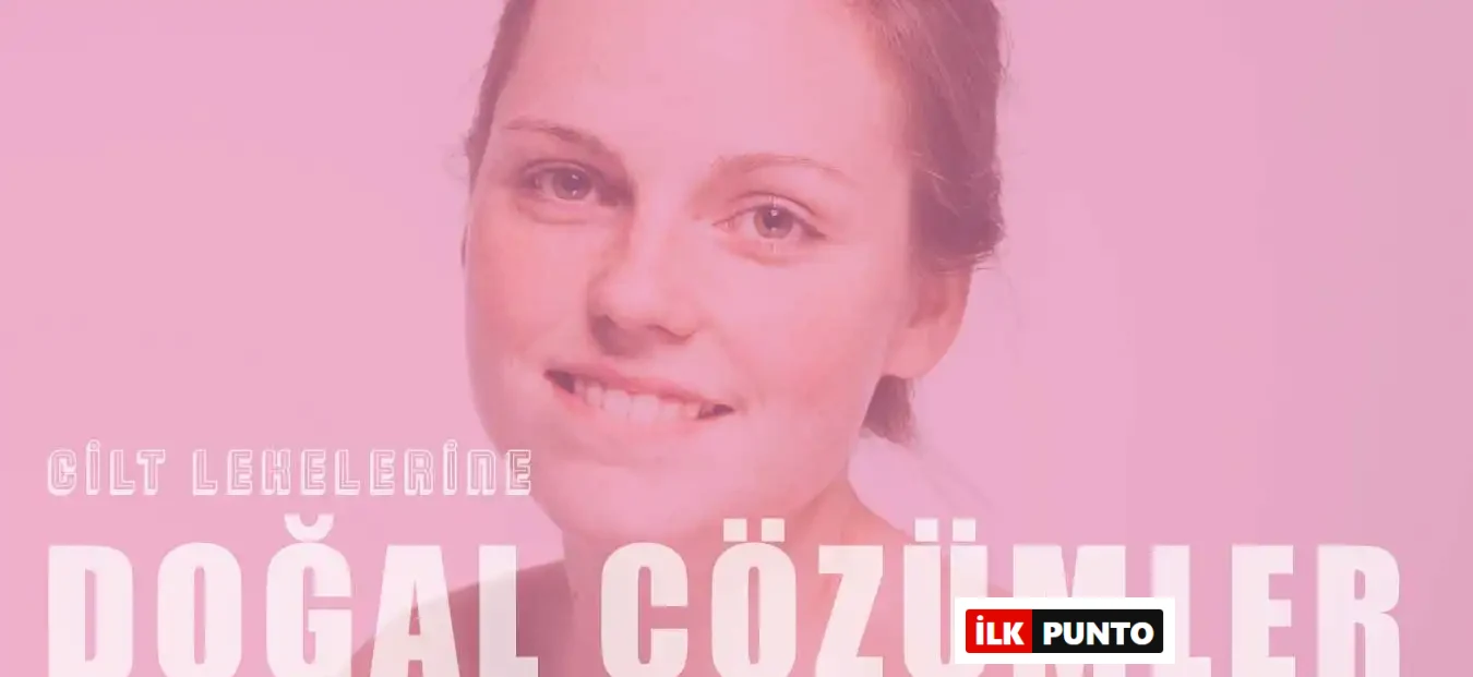 Cilt Lekelerini Gideren Doğal Yöntemler – Sebepler ve Korunma Yolları