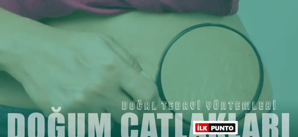 Hamilelik ve Doğum Çatlaklarına Karşı Doğal Yöntemler