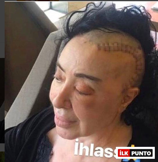 Nur Yerlitaş Hastalığı neydi Nur Yerlitaş Hastalığı